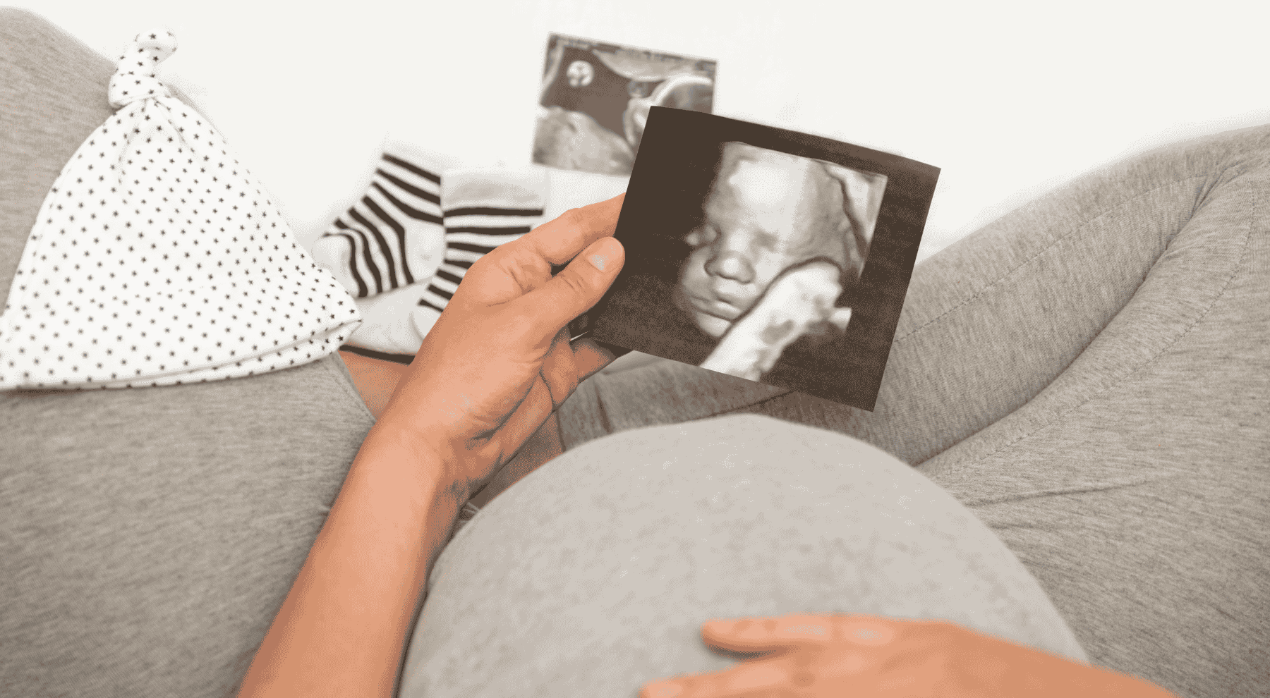 3d ultrasound - fetal vision imaging